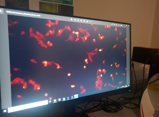 Cancer cells shown on a screen